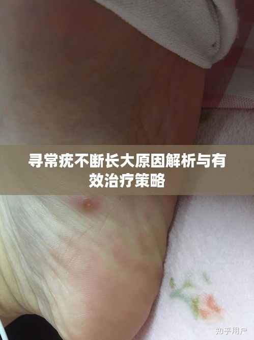 寻常疣不断长大原因解析与有效治疗策略