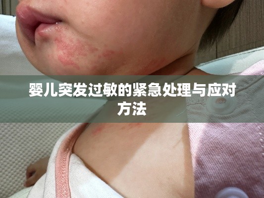 婴儿突发过敏的紧急处理与应对方法